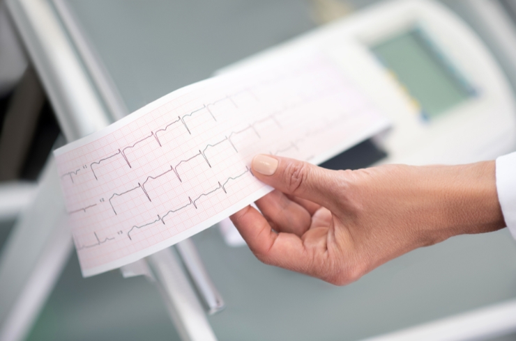 ECG-----31